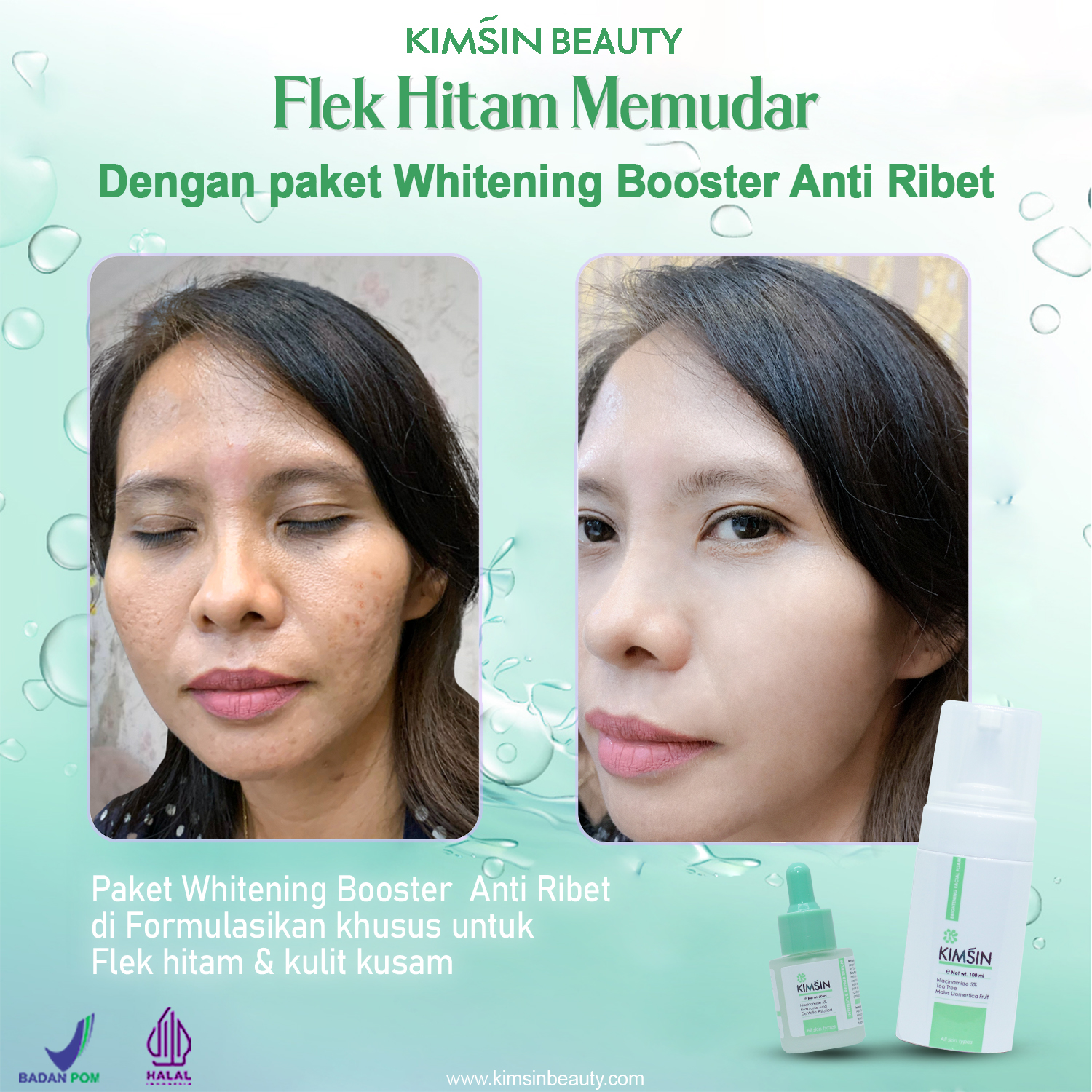 flek hitam memudar dengan paket whitening booster anti ribet